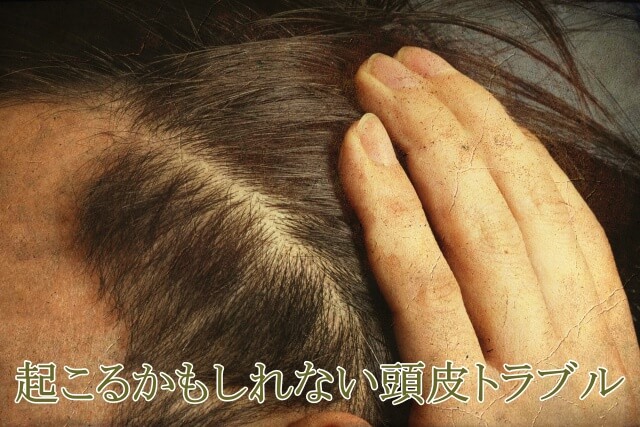 整髪料によって起こるかもしれない頭皮トラブル